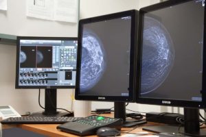oras-ospedale-riabilitativo-motta-di-livenza-tomosintesi